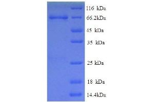 Electron-Transferring-Flavoprotein Dehydrogenase (ETFDH) (AA 34-617) protein (His tag)