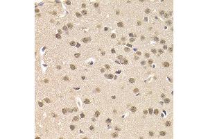 Immunohistochemistry of paraffin-embedded mouse brain using CSNK1E antibody at dilution of 1:200 (400x lens). (CK1 epsilon anticorps)