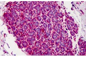 Human Breast: Formalin-Fixed, Paraffin-Embedded (FFPE)