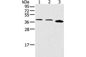 Western blot analysis of Jurkat Hela and 231 cell using CCNG1 Polyclonal Antibody at dilution of 1:400 (Cyclin G1 anticorps)