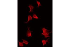 ABIN6272536 staining HepG2 by IF/ICC.