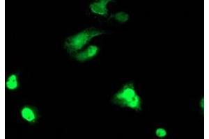 Image no. 3 for anti-T-Cell Acute Lymphocytic Leukemia 1 (TAL1) antibody (ABIN1501288) (TAL1 anticorps)