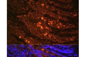 Immunofluorescence analysis of Rat Intestine using TLN1 Polyclonal Antibody at dilution of 1:100.