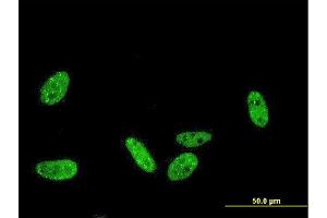 Immunofluorescence of monoclonal antibody to PRKRIP1 on HeLa cell.