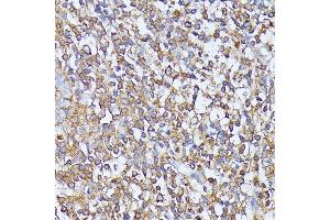 Immunohistochemistry of paraffin-embedded human tonsil using STK24 antibody (ABIN6132364, ABIN6148602, ABIN6148603 and ABIN6214875) at dilution of 1:100 (40x lens).