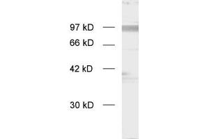 dilution: 1 : 1000, sample: enriched synaptosomal membranes (APP anticorps  (C-Term))