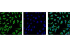 Immunofluorescence (IF) analysis of HeLa with antibody (Left) and DAPI (Right) diluted at 1:100.