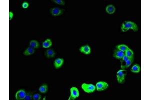 Immunofluorescent analysis of A431 cells using ABIN7168723 at dilution of 1:100 and Alexa Fluor 488-congugated AffiniPure Goat Anti-Rabbit IgG(H+L) (SCAMP2 anticorps  (AA 1-153))