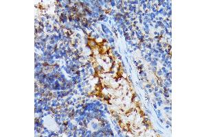Immunohistochemistry of paraffin-embedded mouse spleen using T Rabbit mAb (ABIN7270916) at dilution of 1:100 (40x lens).