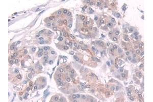 Detection of TPMT in Human Pancreas Tissue using Polyclonal Antibody to Thiopurine Methyltransferase (TPMT)