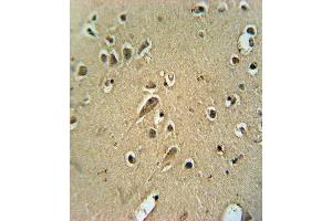 anti-SRY (Sex Determining Region Y)-Box 10 (SOX10) (AA 231-259) antibody