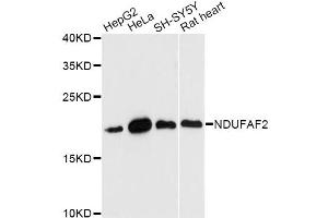 Western blot analysis of extracts of various cell lines, using NDUFAF2 antibody (ABIN6293812) at 1:3000 dilution. (NDUFAF2 anticorps)