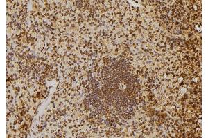 ABIN6277651 at 1/100 staining Rat spleen tissue by IHC-P. (MTR4 anticorps  (Internal Region))