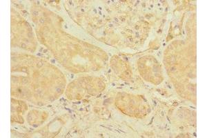 Immunohistochemistry of paraffin-embedded human kidney tissue using ABIN7152170 at dilution of 1:100 (EIF3K anticorps  (AA 1-218))