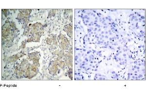 Image no. 3 for anti-VEGF Receptor 2 (VEGFR2) (pTyr1214) antibody (ABIN196768) (VEGFR2/CD309 anticorps  (pTyr1214))