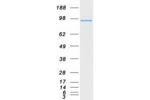 Validation with Western Blot