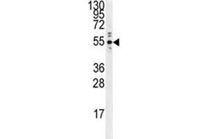 Western blot analysis of PTP1B antibody and Ramos lysate.