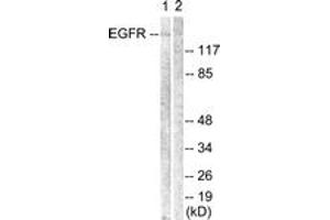 Western blot analysis of extracts from Jurkat cells, using EGFR (Ab-1069) Antibody. (EGFR anticorps  (AA 1031-1080))