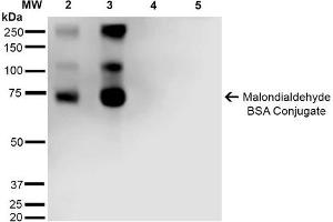 Western Blot analysis of Malondialdehyde-BSA Conjugate showing detection of 67 kDa Malondialdehyde -BSA using Mouse Anti-Malondialdehyde Monoclonal Antibody, Clone 11E3 . (Malondialdehyde anticorps  (FITC))
