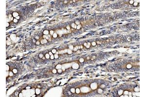 IHC analysis of CLPB using anti-CLPB antibody (ABIN7601732). (CLPB anticorps  (AA 438-707))
