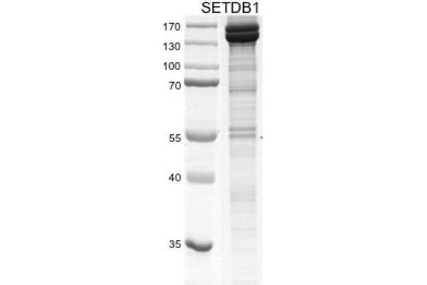 SETDB1 Protein (DYKDDDDK Tag)