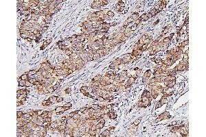 IHC analysis of Hexokinase 1/HK1 using anti-Hexokinase 1/HK1 antibody (ABIN7600260). (Hexokinase 1 anticorps  (AA 17-323))