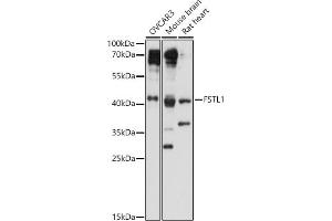 Western blot analysis of extracts of various cell lines, using FSTL1 antibody (ABIN7267227) at 1:1000 dilution. (FSTL1 anticorps  (AA 1-308))