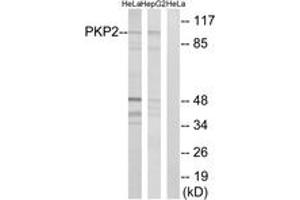 Western blot analysis of extracts from HeLa/HepG2 cells, using PKP2 Antibody. (Plakophilin 2 anticorps  (AA 632-681))