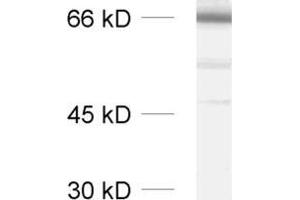 dilution: 1 : 1000, sample: synaptic vesicle fraction of rat brain (LP2) (SYT2 anticorps  (Cytoplasmic Domain))