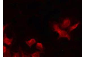 ABIN6269028 staining HeLa by IF/ICC. (CDKN2B anticorps  (Internal Region))