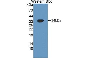 Figure. (NUAK1 anticorps  (AA 421-658))