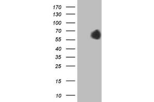 Western Blotting (WB) image for anti-alpha-Fetoprotein (AFP) (AA 19-397) antibody (ABIN2716010) (alpha Fetoprotein anticorps  (AA 19-397))