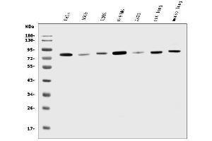 Western blot analysis of K Cadherin/CDH6 using anti-K Cadherin/CDH6 antibody (ABIN7600136).