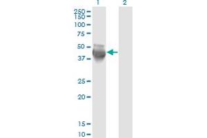 Western Blot analysis of COPS3 expression in transfected 293T cell line by COPS3 monoclonal antibody (M02), clone 2D10.