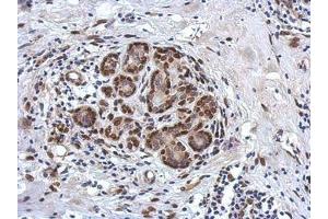 Image no. 1 for anti-Zinc Finger and BTB Domain Containing 20 (ZBTB20) (AA 1-668) antibody (ABIN1501916)