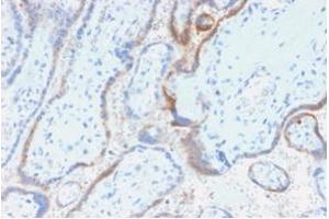 Formalin-fixed, paraffin-embedded human placenta stained with hCG beta Mouse Recombinant Monoclonal Antibody (rHCGb/54).