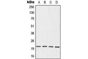 Western blot analysis of OAZ3 expression in HEK293T (A), Jurkat (B), mouse testis (C), rat testis (D) whole cell lysates. (OAZ3 anticorps  (Center))