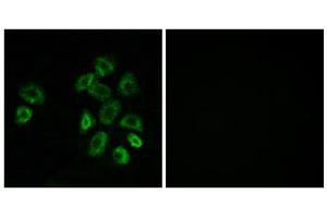 Immunofluorescence analysis of MCF-7 cells, using GPRC5B antibody. (GPRC5B anticorps  (Internal Region))