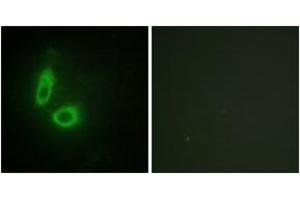 Immunofluorescence analysis of HeLa cells, using EFNA1 Antibody. (Ephrin A1 anticorps  (AA 66-115))