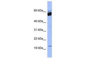 Image no. 1 for anti-S100 Calcium Binding Protein A9 (S100A9) (N-Term) antibody (ABIN6741664)