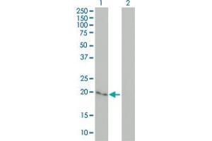 Western Blot analysis of CYGB expression in transfected 293T cell line by CYGB monoclonal antibody (M02), clone 1A1.