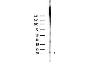 anti-Peripheral Myelin Protein 22 (PMP22) (C-Term) antibody