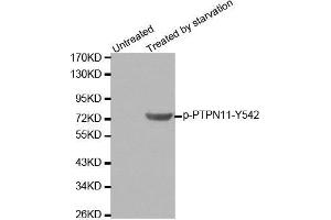Western blot analysis of extracts from 293 cells using Phospho-PTPN11-Y542 antibody. (PTPN11 anticorps  (pTyr542))