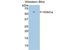 Detection of Recombinant LRP8, Human using Polyclonal Antibody to Low Density Lipoprotein Receptor Related Protein 8 (LRP8) (LRP8 anticorps  (AA 696-941))