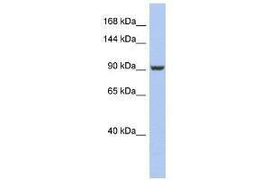 PMS2 antibody used at 1 ug/ml to detect target protein. (PMS2 anticorps)