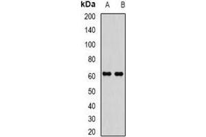 Western blot analysis of EPHX2 expression in MCF7 (A), Jurkat (B) whole cell lysates. (EPHX2 anticorps)