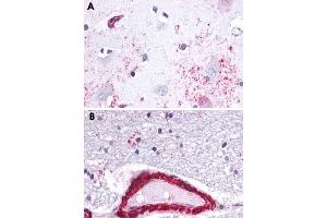 Immunohistochemical staining of formalin-fixed, paraffin-embedded human brain, astrocytes tissue after heat-induced antigen retrieval. (Apelin Receptor anticorps  (3rd Cytoplasmic Domain))
