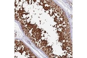Immunohistochemical staining of human testis with LDHC polyclonal antibody ( Cat # PAB28316 ) shows strong cytoplasmic and nuclear positivity in cells in seminiferus ducts at 1:2500 - 1:5000 dilution. (Lactate Dehydrogenase C anticorps)