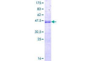Image no. 1 for Sorting Nexin 20 (SNX20) (AA 1-129) protein (GST tag) (ABIN1320880)