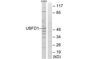 Western blot analysis of extracts from K562 cells, using UBFD1 antibody. (UBFD1 anticorps)